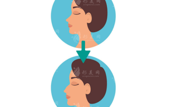 鼻部修復(fù)具體過程是什么呢？