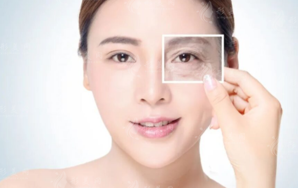 眼部除皺可以手術嗎？能夠解決什么問題？