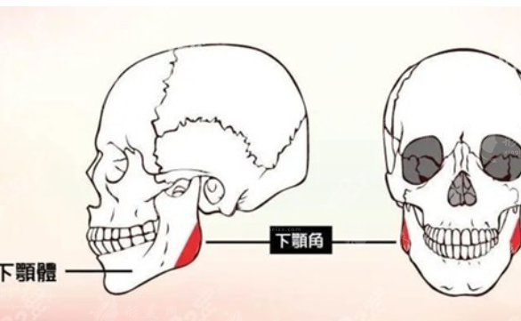 下頜角整形手術(shù)危險(xiǎn)嗎？來詳細(xì)討論下