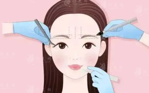 割雙眼皮用電刀割的好嗎？我們來(lái)詳細(xì)探討一下