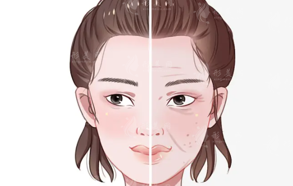 幼態(tài)臉填充用什么材料比較好？各自有什么區(qū)別？