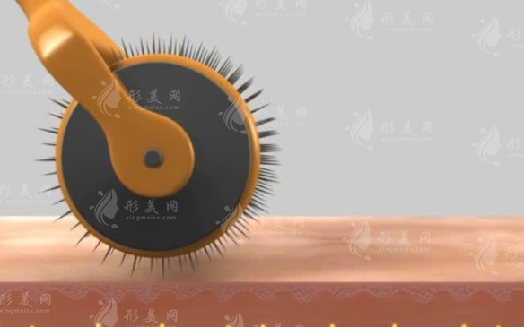 微針滾輪生發(fā)使用頻率是多久？微針滾輪生發(fā)會傷害毛囊嗎