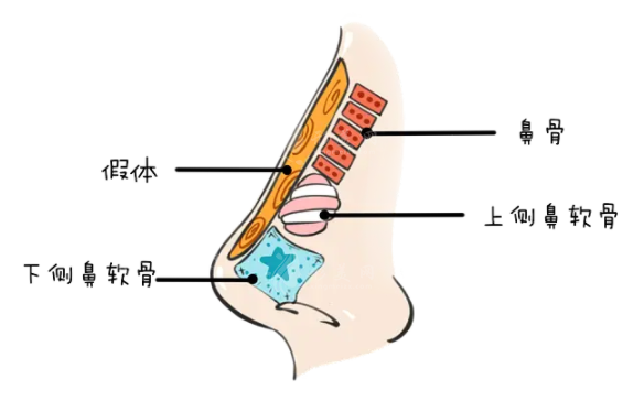 酒糟鼻切割術(shù)與劃痕術(shù)的區(qū)別有哪些？
