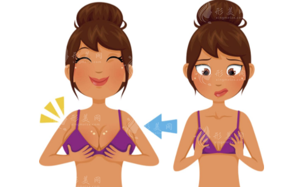 假體隆胸手術(shù)方法有哪些？乳暈切口好嗎？