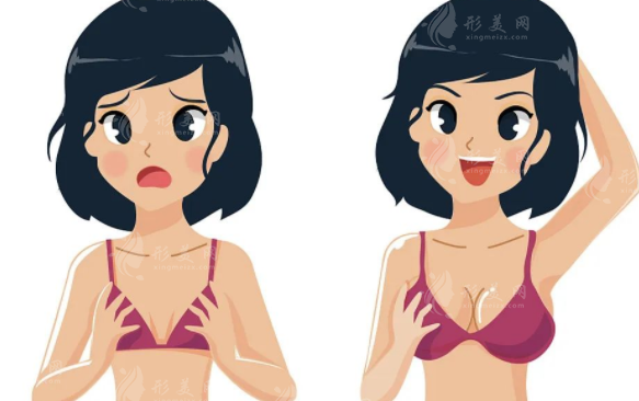 隆胸后包膜攣縮是什么癥狀？怎么解決呢？