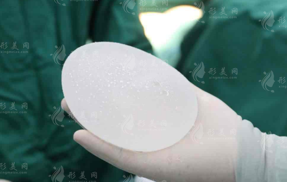 假體隆胸多久取出來比較好？考慮因素有哪些呢？