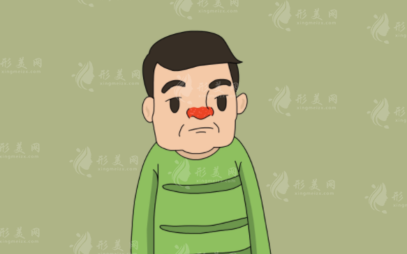 激光如何治療酒糟鼻？原理是什么？