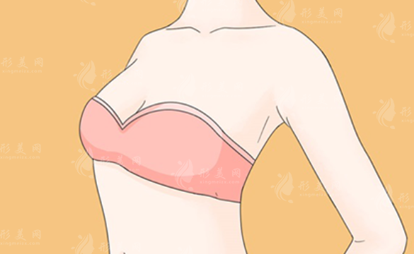 乳房再造手術(shù)的安全性和潛在風(fēng)險(xiǎn)有哪些？