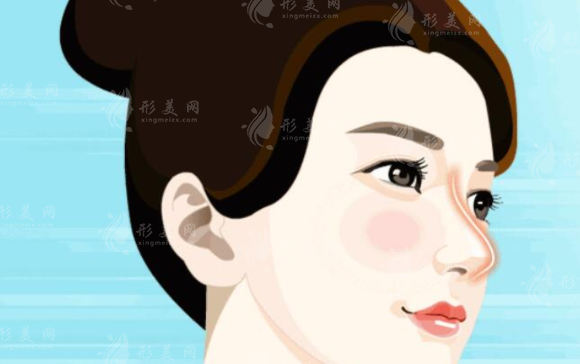 鼻部奧美定取出多久能恢復(fù)呢？手術(shù)方法一覽