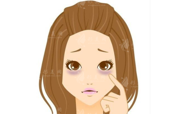 激光去黑眼圈需要多長(zhǎng)時(shí)間？注意事項(xiàng)一覽