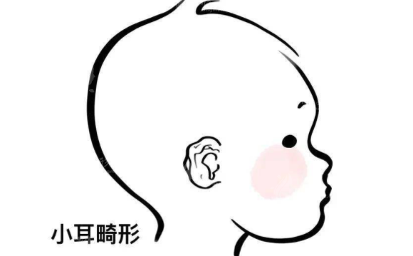 小耳畸形矯正的佳年齡是多少？術(shù)后會(huì)影響聽力嗎？