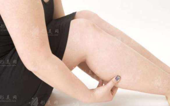 滿足哪些要求可以做吸脂瘦大腿？吸脂瘦大腿要滿足哪些要求？