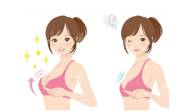 隆胸失敗了醫(yī)院會免費修復嗎？失敗后如何進行針對性修復？