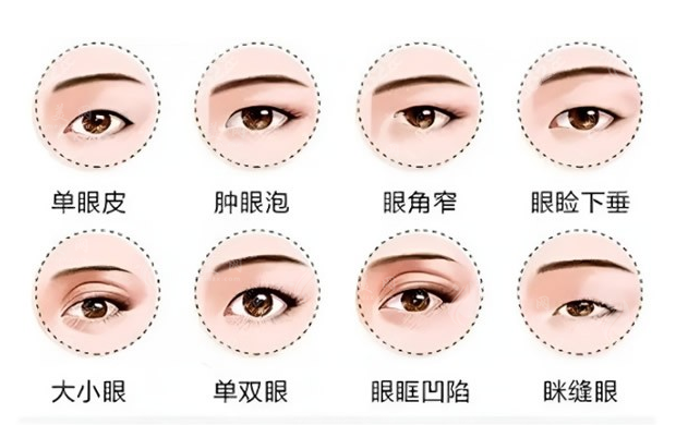 眼部整形