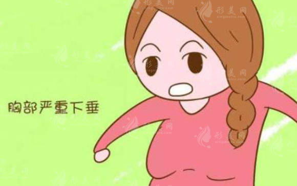 乳房下垂矯正手術(shù)費(fèi)用貴嗎？術(shù)后會(huì)反彈嗎？