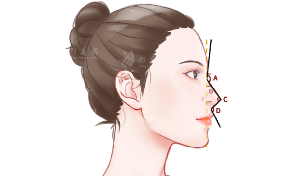 長沙愛思特隆鼻怎么樣？專業(yè)醫(yī)生簡介+案例介紹+收費表一覽