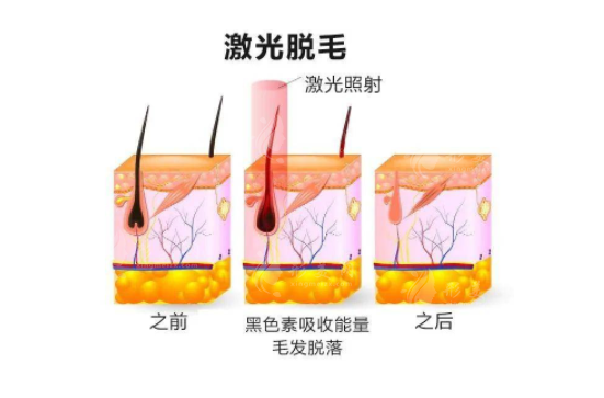 上海九院激光脫毛治療價格表 上海九院激光脫毛治療價格表