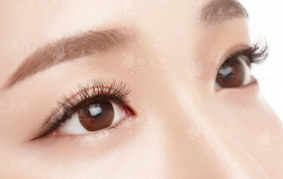 你適合的雙眼皮方式有哪些？適合東方人的眼型有哪些？