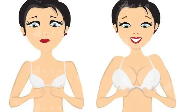 隆胸做隆胸假體好還是自體脂肪好？各有哪些優(yōu)勢呢？