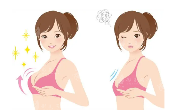 隆胸假體有保質(zhì)期嗎？在體內(nèi)放置多長時(shí)間？