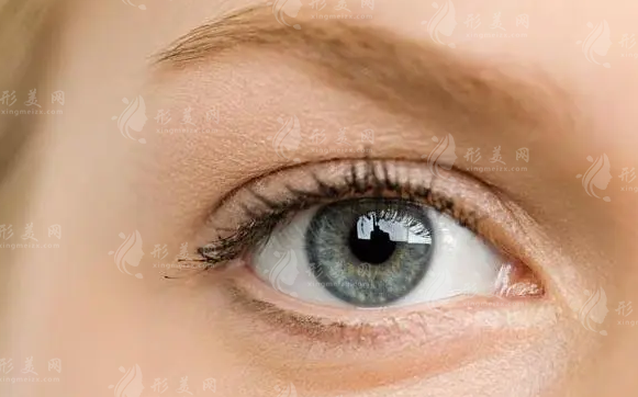 如何判斷是否適合開(kāi)眼角？開(kāi)眼角的優(yōu)勢(shì)是什么？