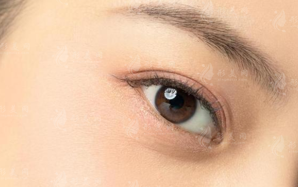內(nèi)眥贅皮術(shù)會留疤嗎？需要多少錢？