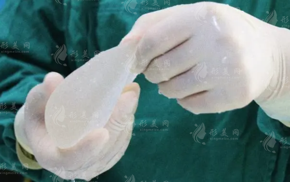 假體隆胸手術(shù)能做局麻嗎？局麻好還是全麻好？