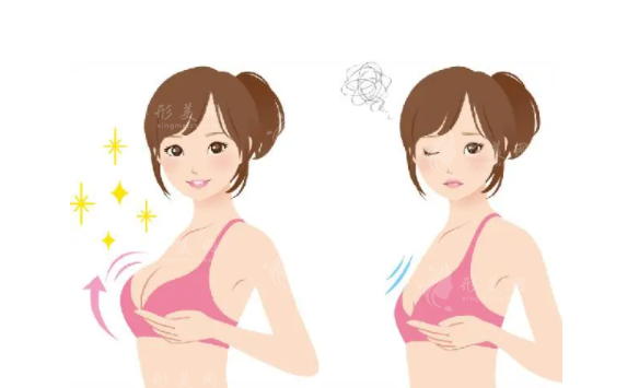 內(nèi)窺鏡雙平面隆胸效果怎么樣？收費(fèi)貴嗎？