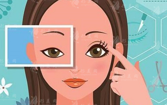 成都素美雙眼皮整形怎么樣？人氣醫(yī)生介紹、價(jià)格表分享！