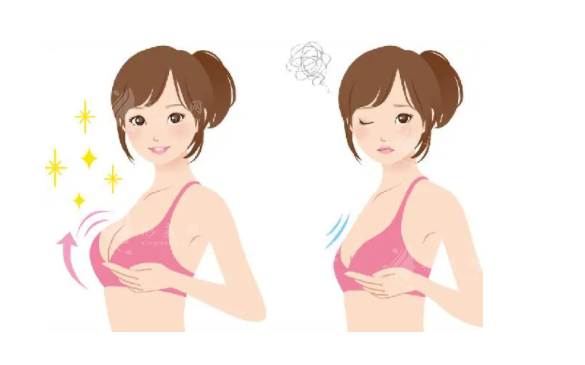 隆胸的腫脹要多久才能消退？術后需要注意什么呢？