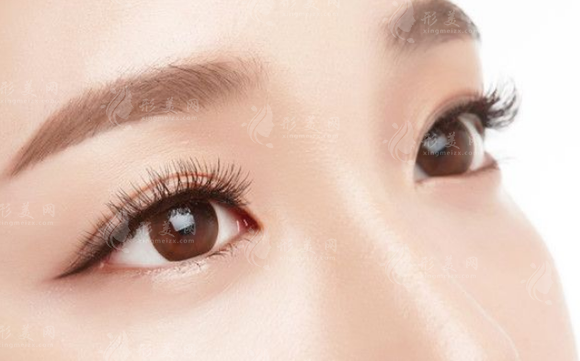 微創(chuàng)雙眼皮能維持多久？術(shù)后注意事項(xiàng)有哪些？