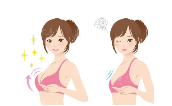 北京潤(rùn)美玉之光整形豐胸怎么樣？坐診醫(yī)生、豐胸案例、2024價(jià)格表