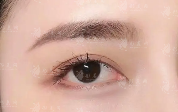 隆眉弓手術(shù)要多少錢？項目風(fēng)險高嗎？