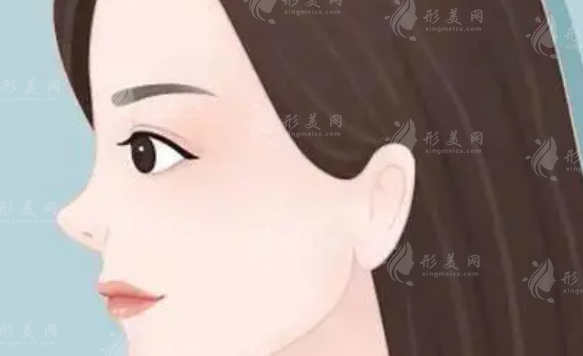 北京畫美醫(yī)院隆鼻整形怎么樣？醫(yī)生專家簡介、案例介紹、收費(fèi)標(biāo)準(zhǔn)