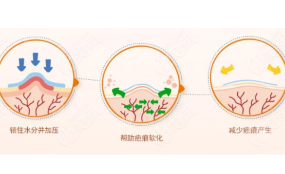 西京醫(yī)院激光祛疤怎么樣？實(shí)力醫(yī)生介紹、案例分享、全新價(jià)格表公開