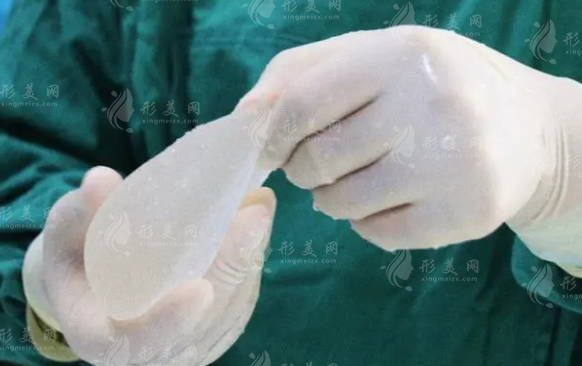 曼托假體豐胸價(jià)格是多少?影響價(jià)格的因素來了~