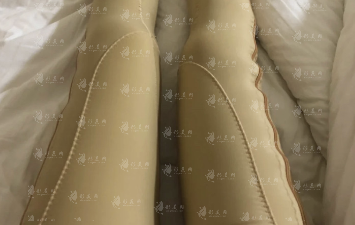 腿部吸脂手術(shù)怎么樣?多久才能擁有纖纖玉腿~