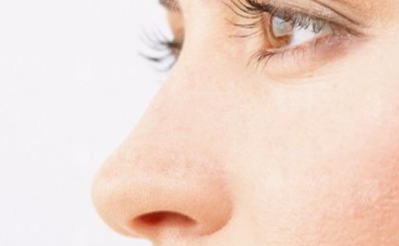 硅膠隆鼻可以保持多久的效果? 硅膠隆鼻可以保持多久的效果?