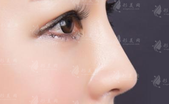 耳軟骨墊鼻尖后遺癥有哪些呢？可以避免嗎？