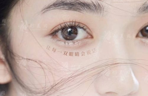 上海九院整形科雙眼皮手術(shù)價(jià)格價(jià)格表及做雙眼皮好醫(yī)生名單