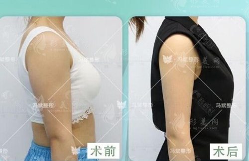 北京純脂醫(yī)療美容醫(yī)院怎么樣？馮斌醫(yī)生實(shí)力介紹