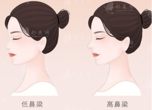 深圳藝星?？溯x做鼻子怎么樣？預(yù)約面診/做自然款媽生鼻2w+