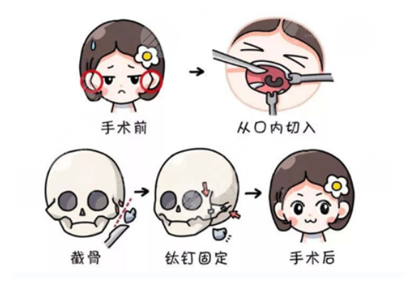 上海時(shí)光整形磨骨有哪些技術(shù)優(yōu)勢(shì)？