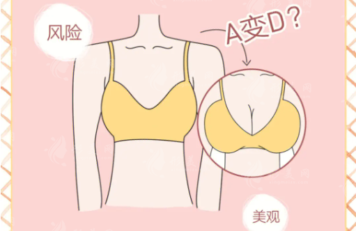 分享我在天津美萊做假體隆胸經(jīng)歷，沈正宇醫(yī)生隆胸技術(shù)簡直不要太牛