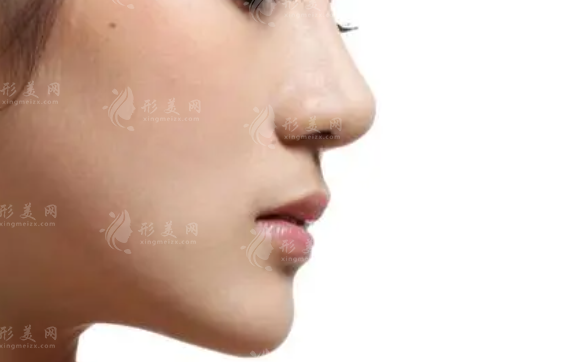 重慶藝星鼻子整形手術(shù)，優(yōu)質(zhì)醫(yī)生介紹，案例分享，附價(jià)格表