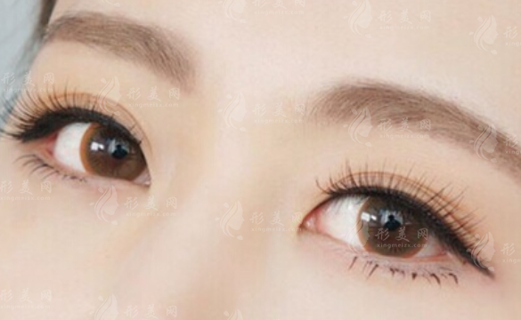 切眉術(shù)和提眉術(shù)的區(qū)別有哪些？