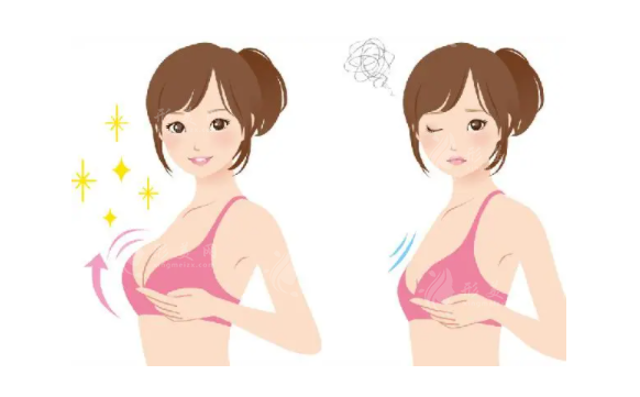 做了脂肪隆胸后可以喂母乳嗎？
