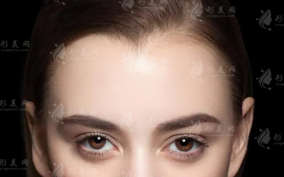 種植美人尖需要多少錢？與哪些因素有關(guān)？