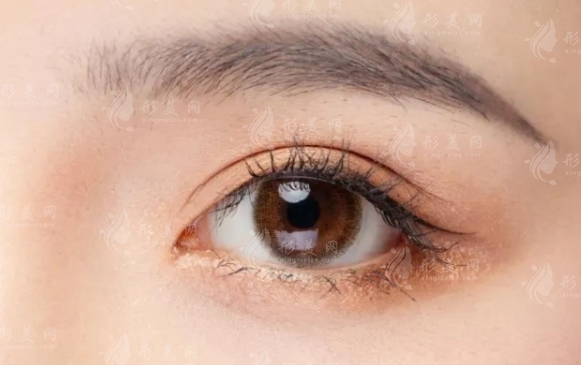 內(nèi)雙割雙眼皮多少錢？價格的高低和哪些因素有關(guān)？