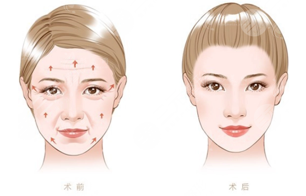 國內(nèi)拉皮手術(shù)醫(yī)生排名，王志軍/穆寶安等知名醫(yī)生榜上有名！